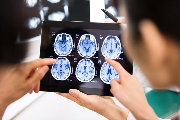 Doctors explaining how can sleep help prevent neurodegenerative diseases